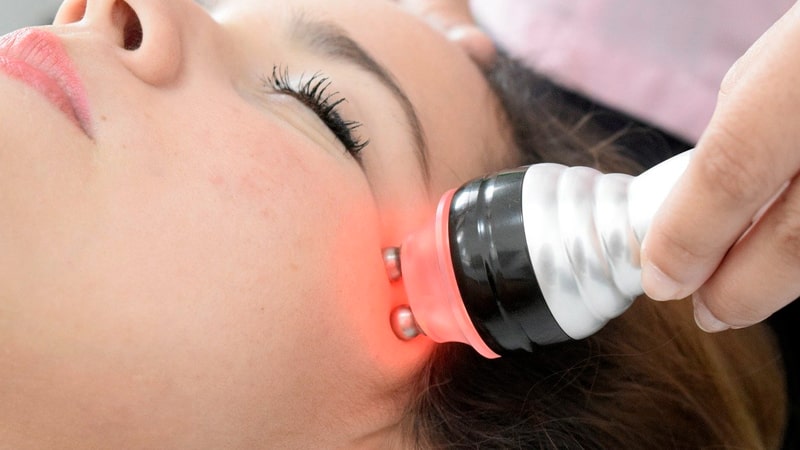 Tratamiento de radiofrecuencia facial