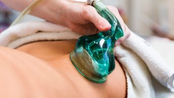 Sesión de vacumterapia en el glúteo