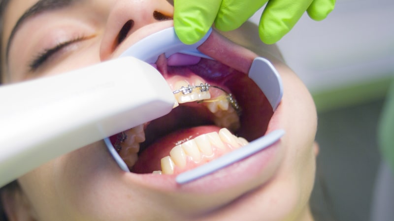 Atención a una paciente en el dentista