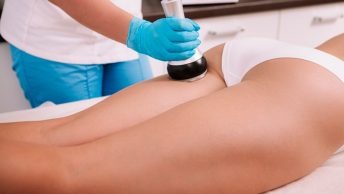 Sesión de radiofrecuencia en clínica estética