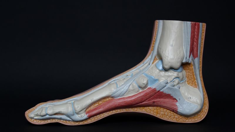 Sesamoiditis: el dolor que impide caminar 1
