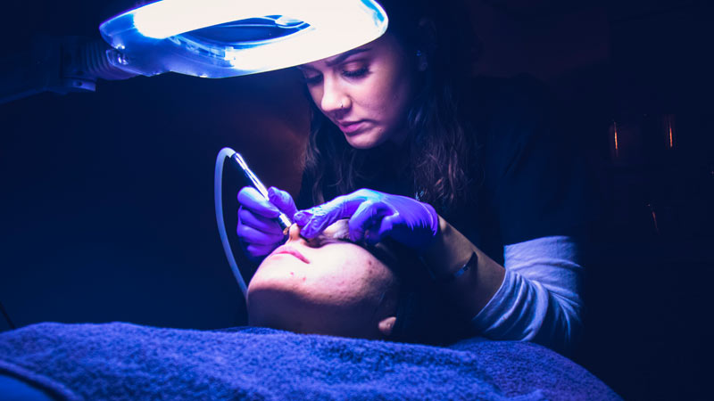 Microdermoabrasión: qué es y en qué consiste 1 Tratamiento microdermoabrasión