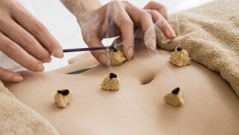 Operario coloca la moxa en un tratamiento de moxibustión