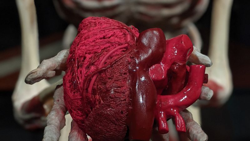 Dolor referido de origen visceral 1