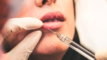 Mujer en un procedimiento de relleno de labios