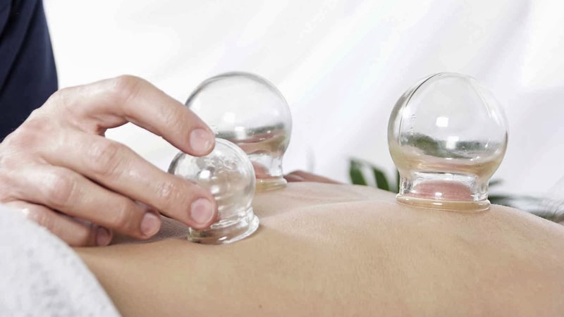 Terapia con ventosas para el dolor crónico
