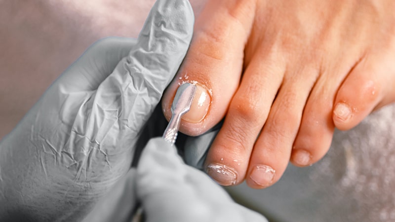 Cuidados pedicura