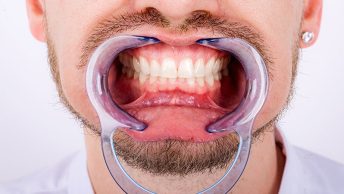 Periodoncia