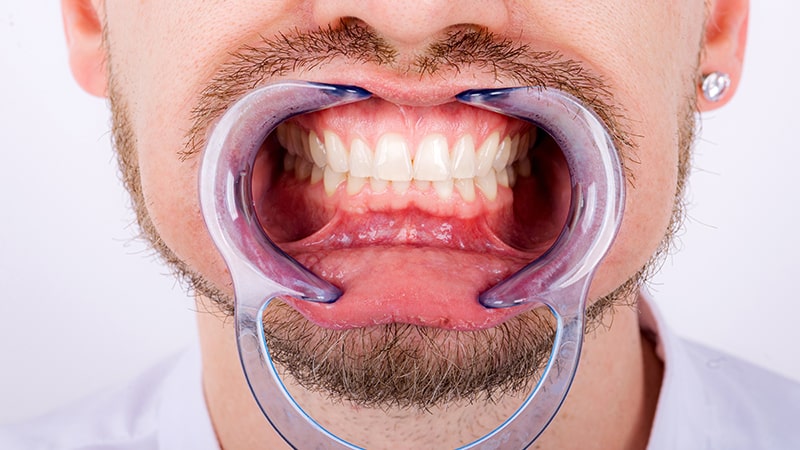 Periodoncia: diagnóstico, tratamiento y mantenimiento del paciente 1 Periodoncia