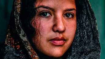 Chica con manchas en la cara