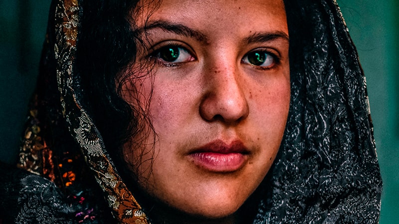 Chica con manchas en la cara