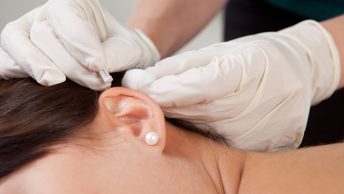 Practicando auriculoterapia a una mujer