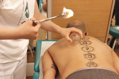 Ventosas y moxibustión