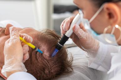 Técnico Auxiliar en Cirugía capilar