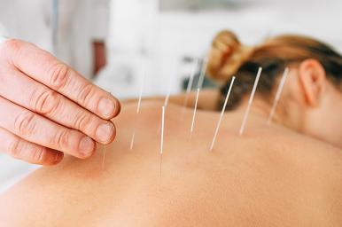 Puntos tendinomusculares para el dolor de espalda