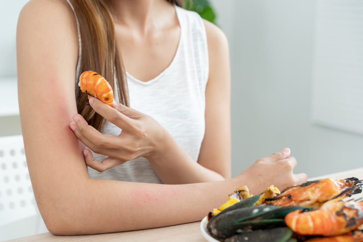 Alergias alimentarias