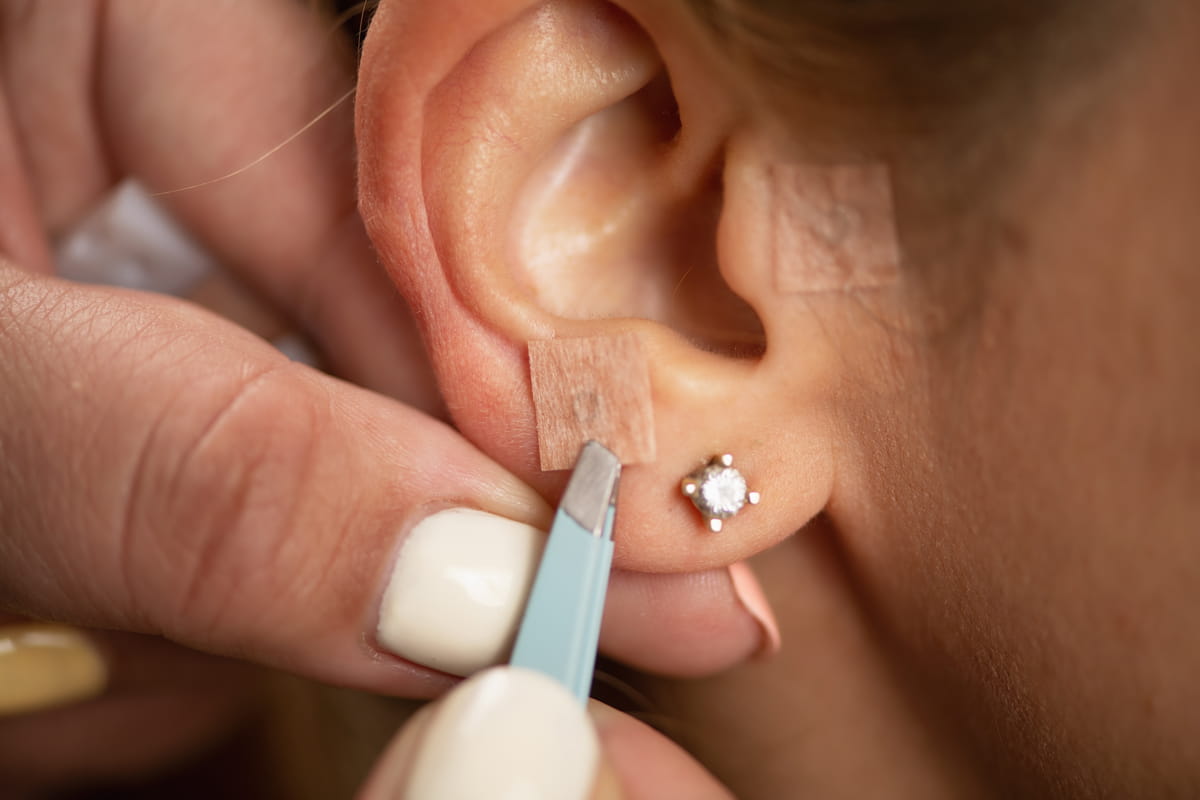 Auriculoterapia